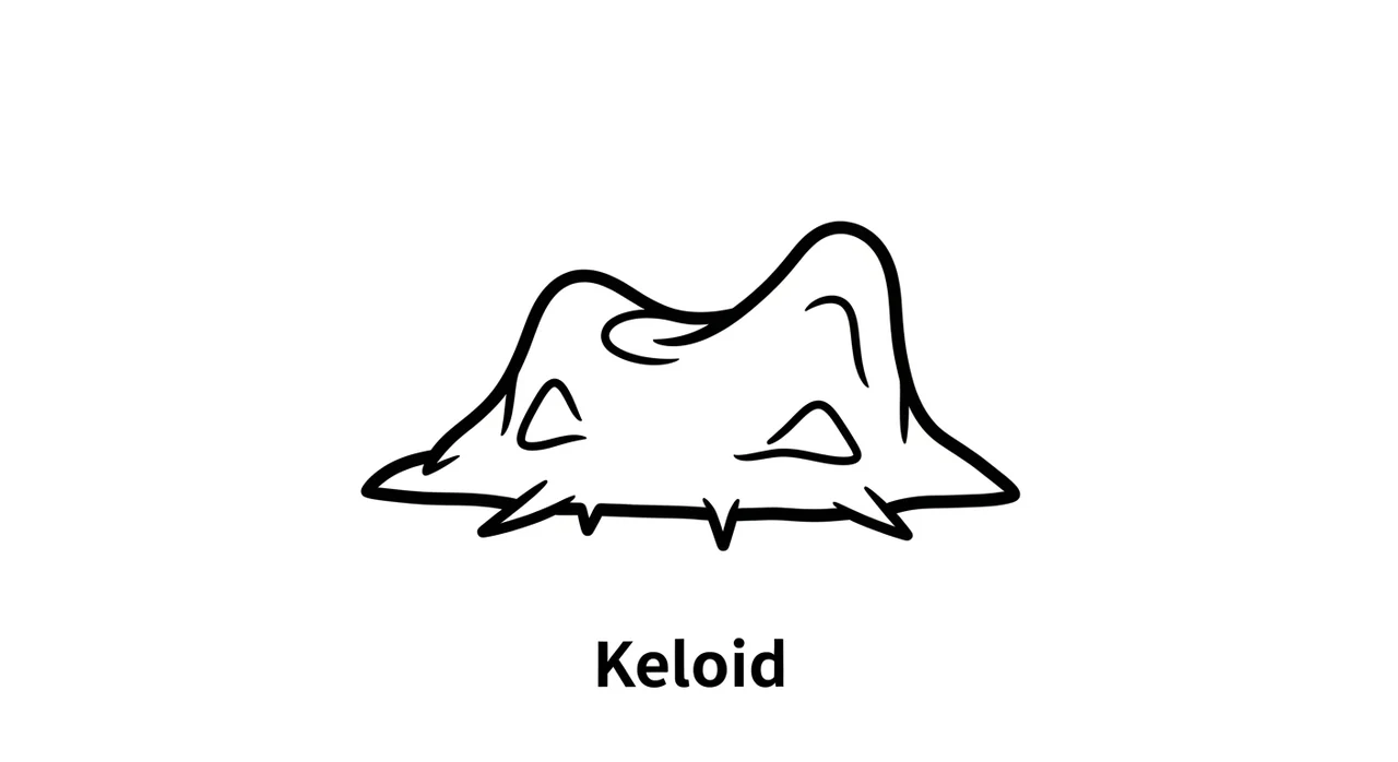 귓볼 몽우리의 주요 원인 5가지