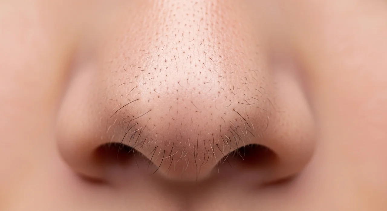 소극성속모증 완벽 가이드: 블랙헤드와 차이점 및 제거 방법 3가지