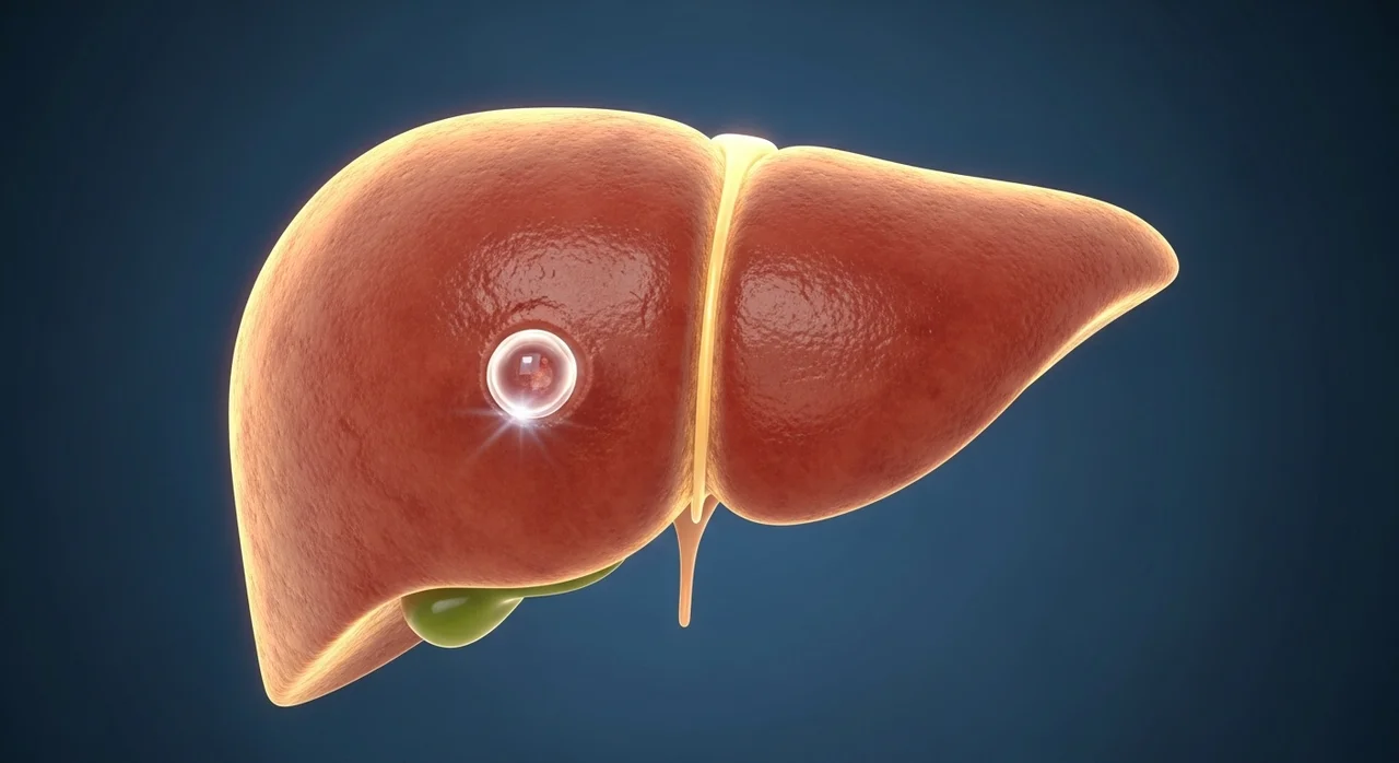 간낭종 원인 증상부터 제거 수술까지: 간 물혹 관리 가이드