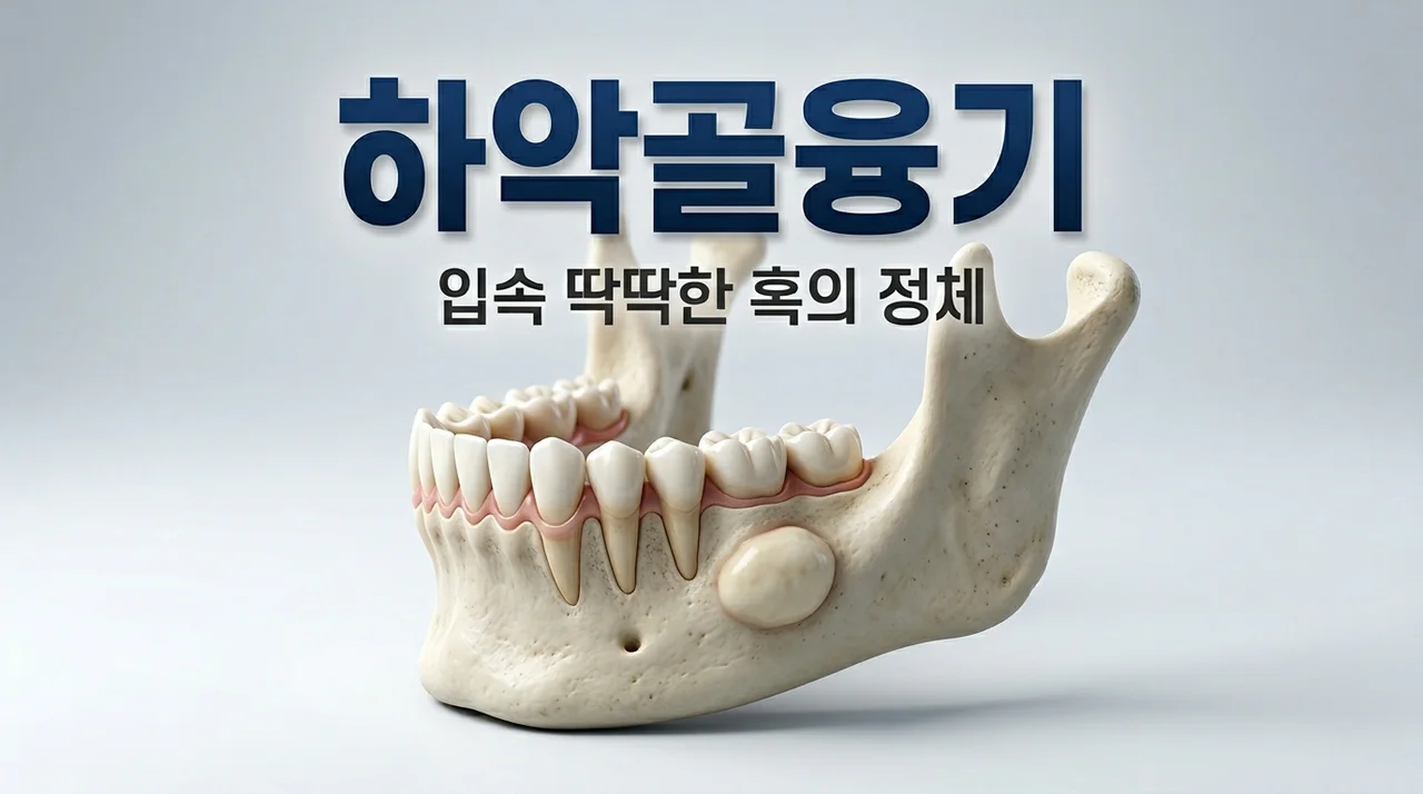 하악골융기 혀 아래 딱딱한 혹 정체와 원인 수술 비용 총정리