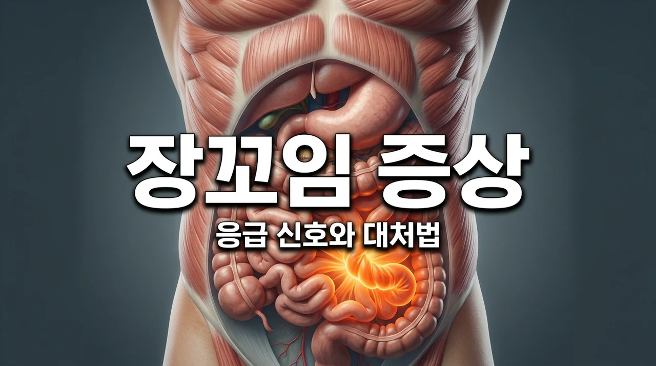 장꼬임증상 6가지 체크리스트: 창자가 쥐어짜듯 아프다면 필독