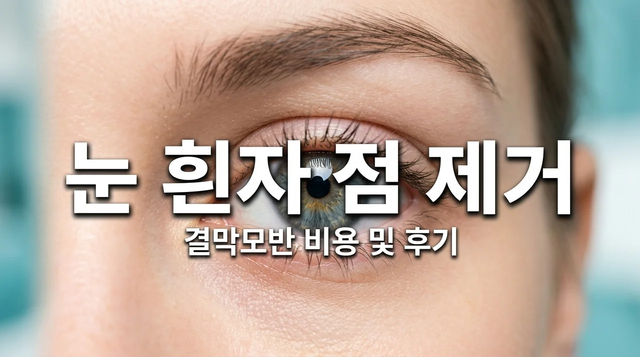 결막모반 제거 비용 및 레이저 수술 후기: 눈 흰자 점 없애는 법 총정리