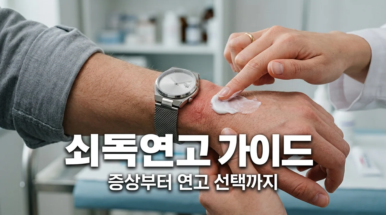 쇠독연고 추천 및 증상 완화 가이드: 가려움 해결하는 법