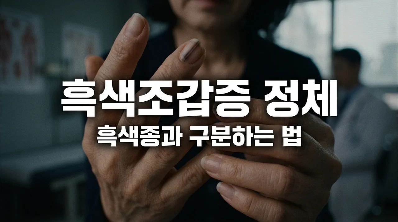 흑색조갑증 손톱 검은 세로줄 원인과 흑색종 구별하는 법