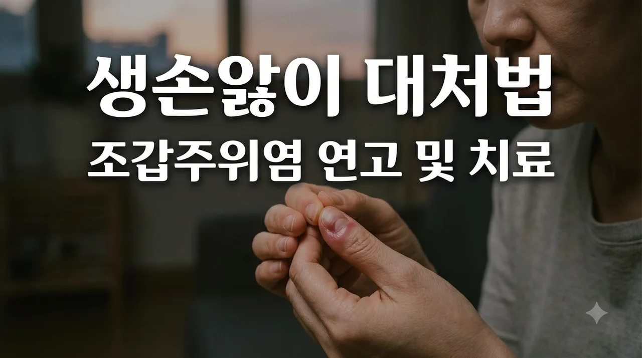생손앓이 초기 증상과 약국 연고 치료법: 조갑주위염 고름 절개 전 필수 수칙